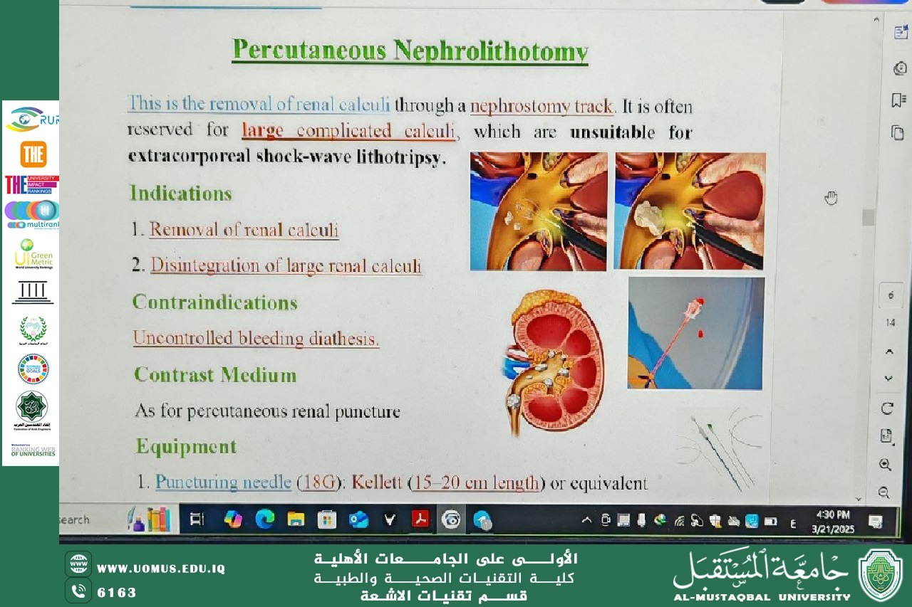 استمرار المحاضرات  إلالكترونية لطلبة المرحلة الثانية في قسم تقنيات الأشعة حول "استخراج حصى الكلى عبر التداخل الناظوري"من قبل التدريسي سامر شربة 