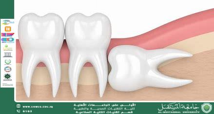 Stem Cells in the Wisdom Tooth: Their Importance and Uses