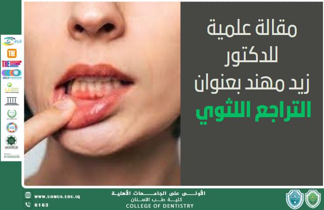 مقالة علمية جديدة للدكتور زيد مهند بعنوان التراجع اللثوي 