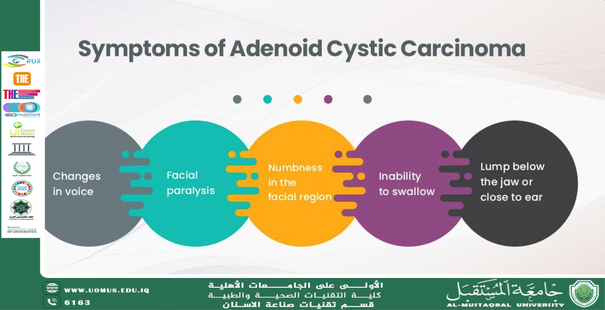 Adenoid Cystic Carcinoma and HPV Adenoid cystic carcinoma (ACC) is a rare and slow-growing malignant neoplasm that primarily arises in the salivary glands but can also occur in other glandular tissues such as the lacrimal glands, trachea, and breast. It is notable for its unique histological features, including cribriform patterns, perineural invasion, and a propensity for distant metastases rather than lymphatic spread. Human papillomavirus (HPV), a DNA virus associated with a range of cancers, has been implicated in the pathogenesis of various malignancies, particularly those affecting the oropharynx. Recent studies have explored the potential role of HPV in ACC, shedding light on its etiological and prognostic implications.