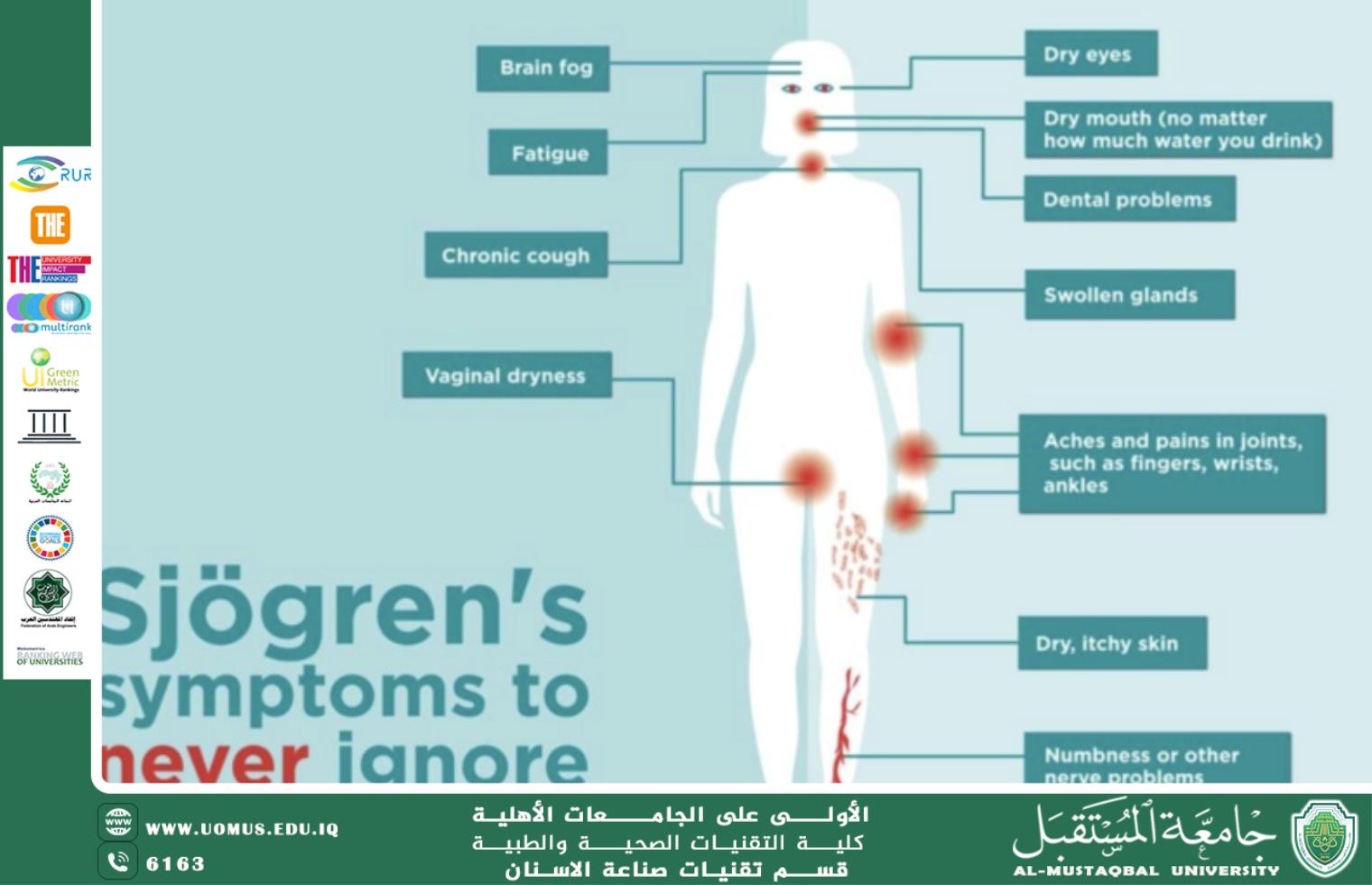 Sjögren’s Syndrome and Rheumatoid Arthritis