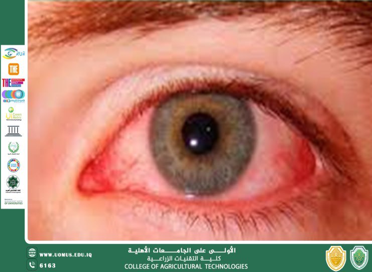 مقالة للاستاذ الدكتور احمد جميل الطائي بعنوان (الحمى النزفية اعراضها وطرق انتقالها والوقاية من المرض