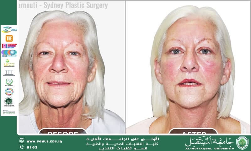 حملة توعوية “ازرع شجرة” لتعزيز الاستدامة البيئية في إطار أهداف التنمية المستدامة