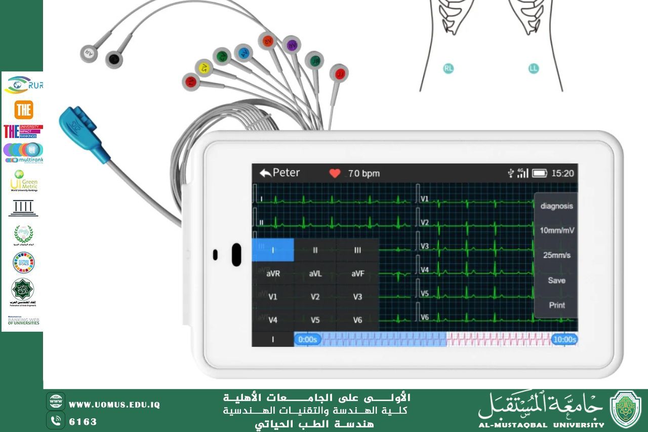 مقالة بعنوان "‏electrocardiogram"للمهندسة زهراء محمد كاظم