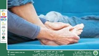 مقالة علمية للتدريسية (م.م سجى جواد عبيد ) بعنوان "الروماتيزم"