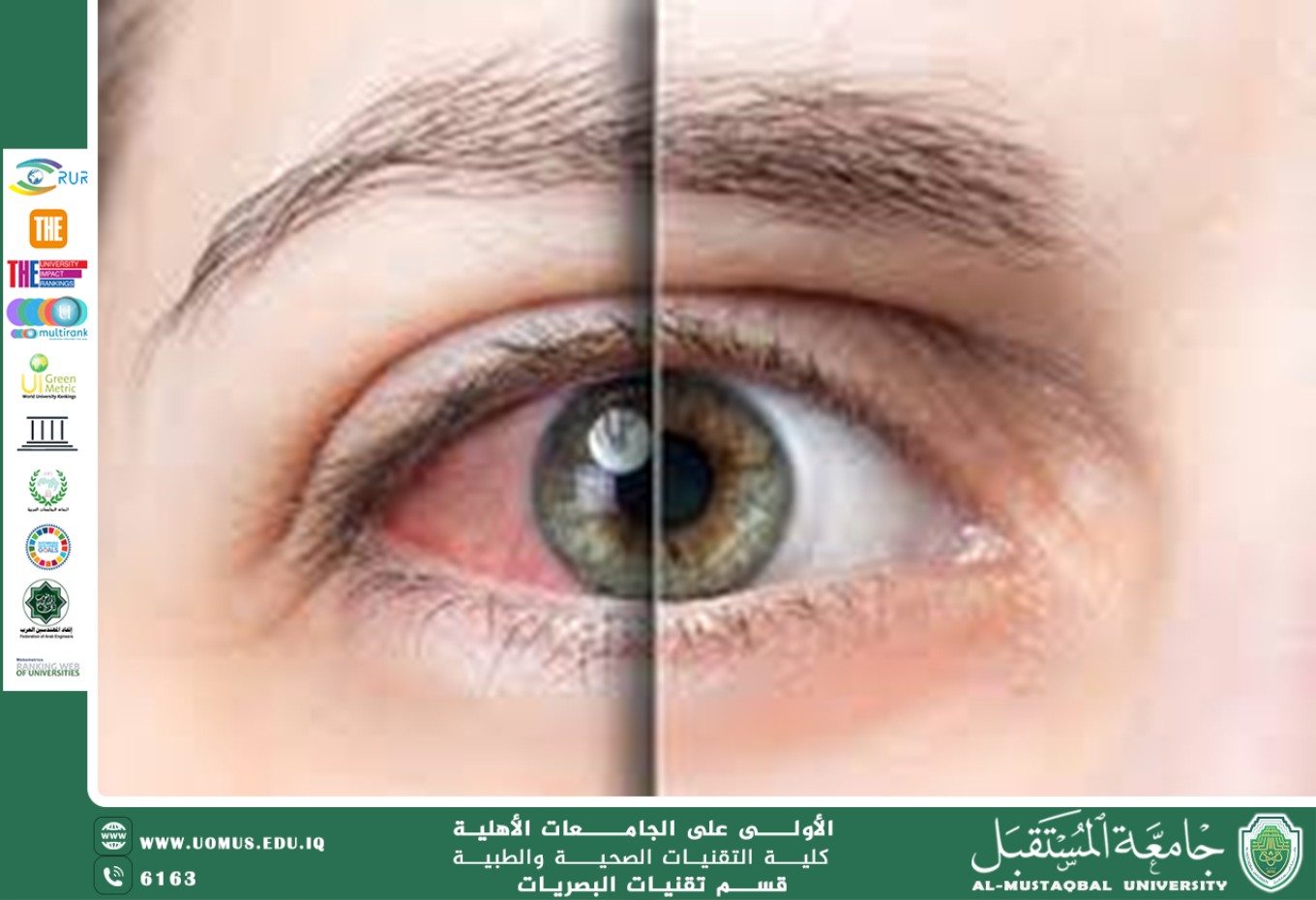 مقالة علمية لرئيس قسم تقنيات البصريات أ.م.د.منذر سمين شكر بعنوان(الوقاية من العمى).