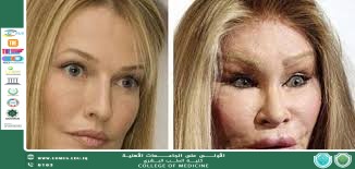 The Negative Impact of Cosmetic Surgery on Women
