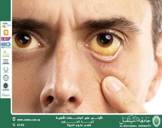 A scientific article by teaching assistant Banin Maan Karim entitled "yellow fever"