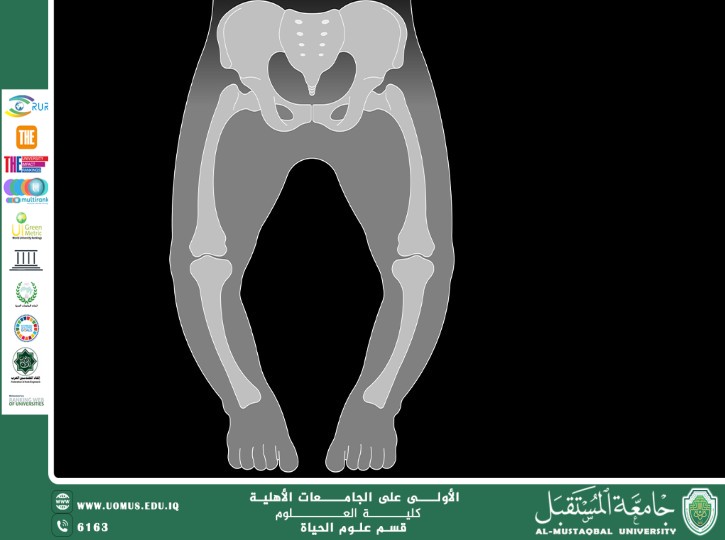 مقالة علمية للمعيدة بنين معن كريم بعنوان " مرض الكساح "