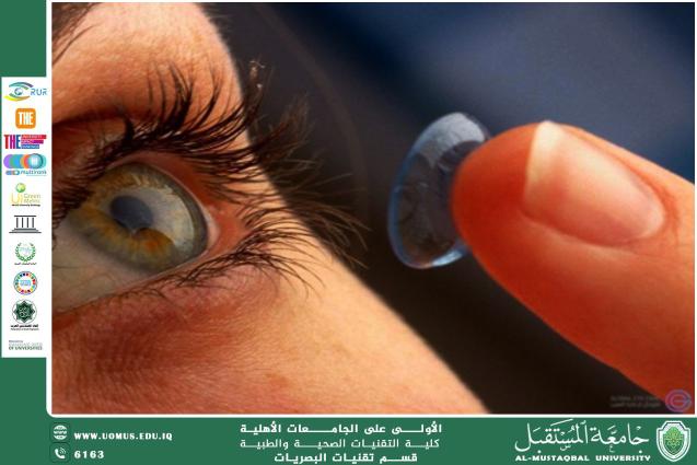  A scientific article by the lecturer,Asst. Lecturer Hassan Abdulhadi Al-Jaberi (The Effect of Soft Contact Lens Wear on Corneal Endothelial Cell Characteristics)