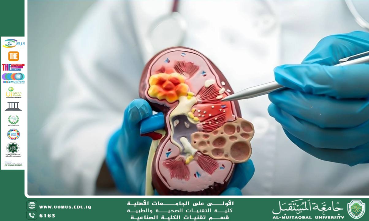 أسباب ارتفاع اليوريا (Urea)في الدم: 