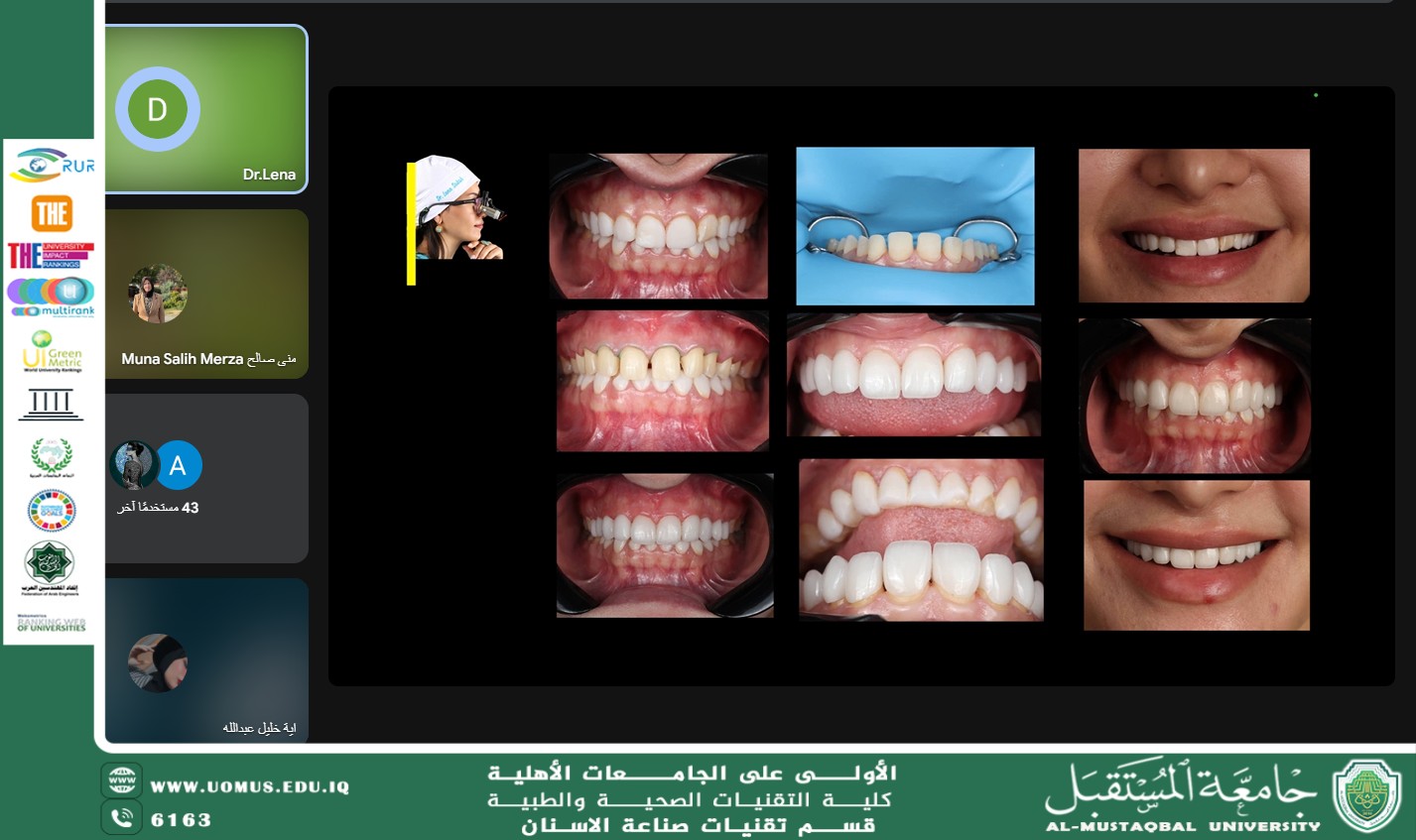 A scientific workshop that highlights the golden standards in the implementation of dental crowns and bridges