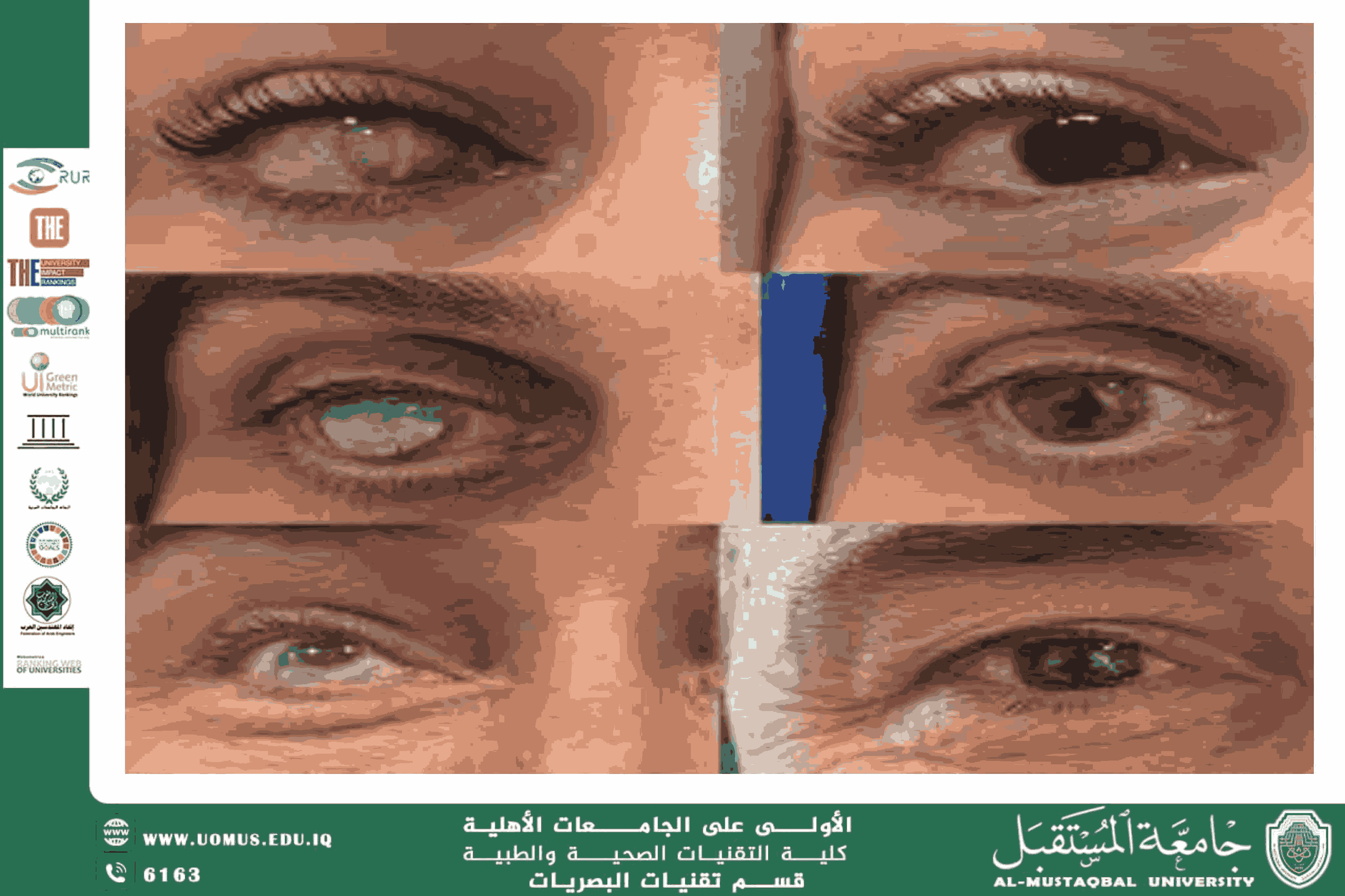 مقالة علمية للتدريسي م.م. روشن قاسم جمعة (وشم العين)