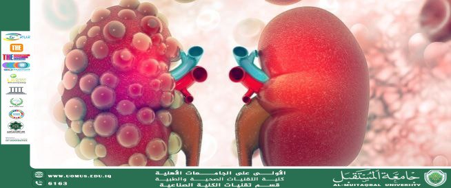 مرض الكلى المتعدد الكيسات : الأعراض الأسباب والعلاج 