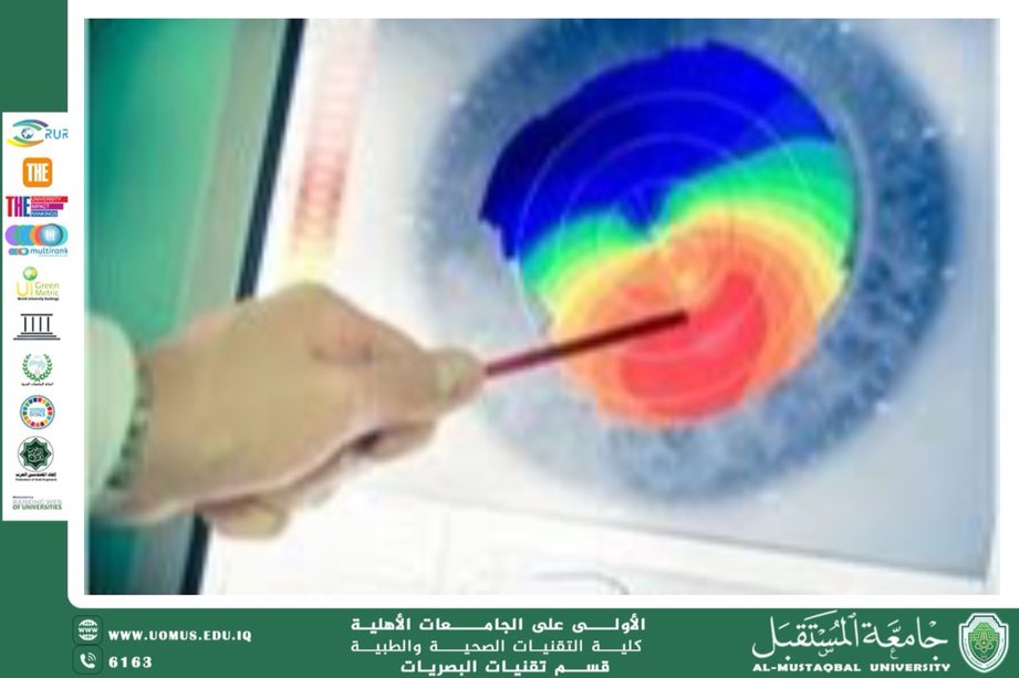 A scientific article by Assistant Lecturer Mohaimen Sameer Aref titled ( The Role of Wavefront Analysis in Diagnosing and Correcting Higher-Order Aberrations: A Modern Perspective in Optometry and Ophthalmic Technology)