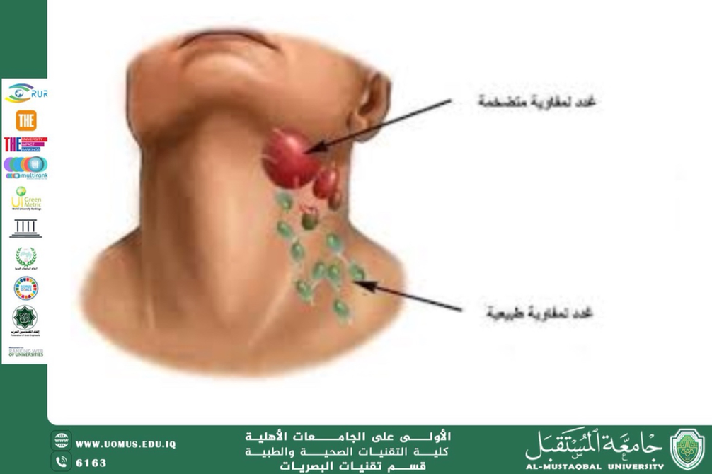 A scientific article by Assistant Lecturer Hassan Qahtan titled (The Impact of Lymph Node Inflammation on the Eye: A Comprehensive Clinical Perspective)