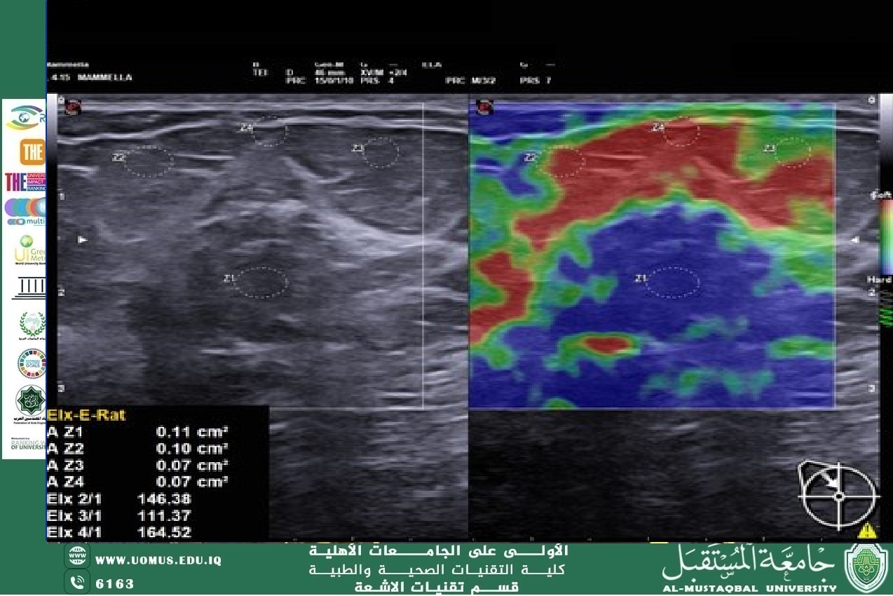 Article Title: "Medical Ultrasound: From Conventional Imaging to Elastography" by Lecturer Durgam Yousif