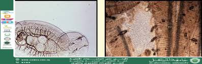 Do Fish Parasites Transmit to Humans?” by Assoc. Prof. Dr. Fatima Hashim Abbas